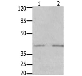 GFRA3 Antibody from Signalway Antibody (31207) - Antibodies.com