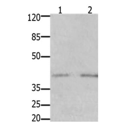 GFRA3 Antibody from Signalway Antibody (31207) - Antibodies.com