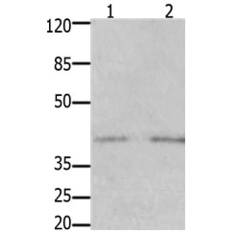 GFRA3 Antibody from Signalway Antibody (31207) - Antibodies.com