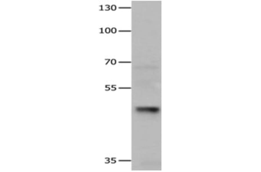 HDAC3 Antibody from Signalway Antibody (31216) - Antibodies.com