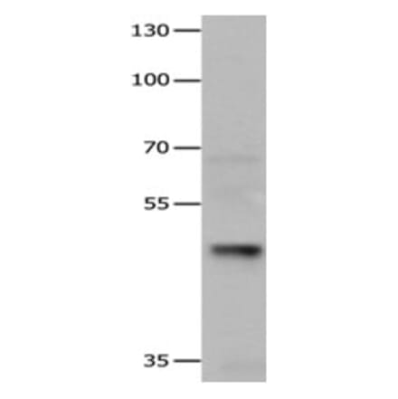 HDAC3 Antibody from Signalway Antibody (31216) - Antibodies.com