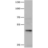 HDAC3 Antibody from Signalway Antibody (31216) - Antibodies.com