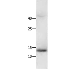 HMGA2 Antibody from Signalway Antibody (31218) - Antibodies.com