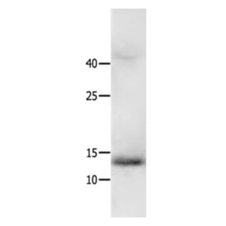 HMGA2 Antibody from Signalway Antibody (31218) - Antibodies.com