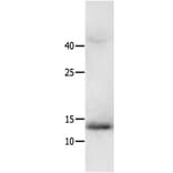 HMGA2 Antibody from Signalway Antibody (31218) - Antibodies.com