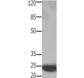 HMGB2 Antibody from Signalway Antibody (31219) - Antibodies.com