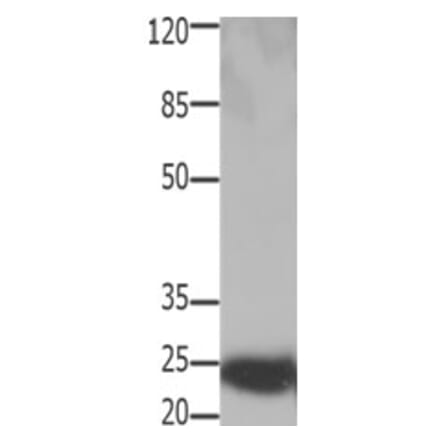 HMGB2 Antibody from Signalway Antibody (31219) - Antibodies.com