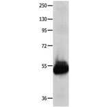 KCNA1 Antibody from Signalway Antibody (31226) - Antibodies.com