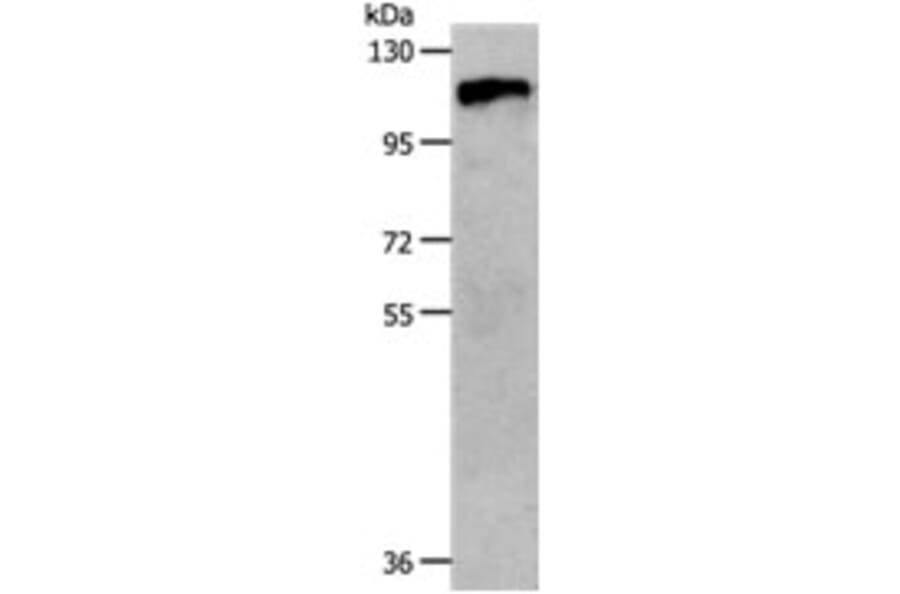 CSF1R Antibody from Signalway Antibody (31235) - Antibodies.com