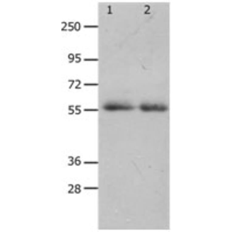 MMP17 Antibody from Signalway Antibody (31237) - Antibodies.com
