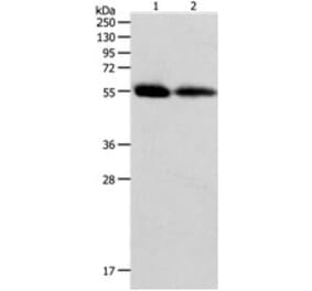 MMP11 Antibody from Signalway Antibody (31240) - Antibodies.com
