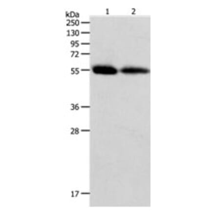 MMP11 Antibody from Signalway Antibody (31240) - Antibodies.com