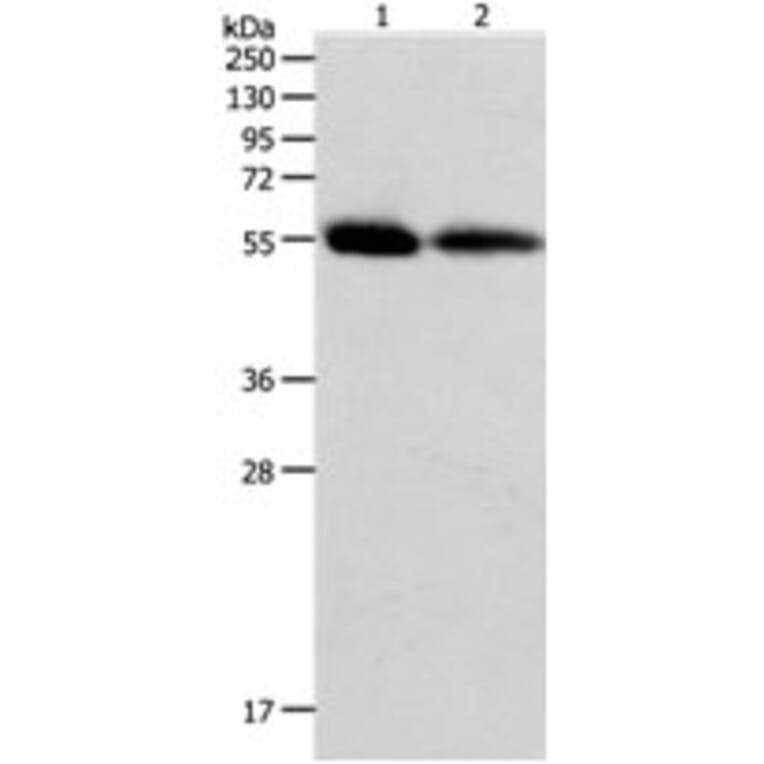 MMP11 Antibody from Signalway Antibody (31240) - Antibodies.com
