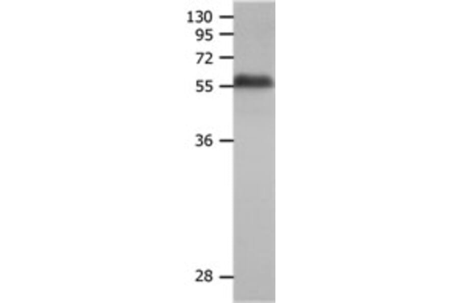 MMP19 Antibody from Signalway Antibody (31241) - Antibodies.com