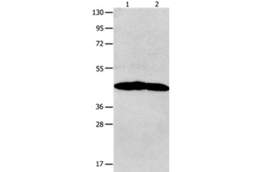 NTSR1 Antibody from Signalway Antibody (31251) - Antibodies.com