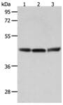 Gel: 10% SDS-PAGE Lane1: Human fetal lung tissue lysate Lane2: A549 cell lysateLane3: Mouse lung tissue lysate. Lysates: 40 µg per lane. Primary antibody: 1/200 dilution. Secondary antibody: Goat anti Rabbit IgG - H&L (HRP) at 1/10000 dilution. Exposure time: 5 minutes