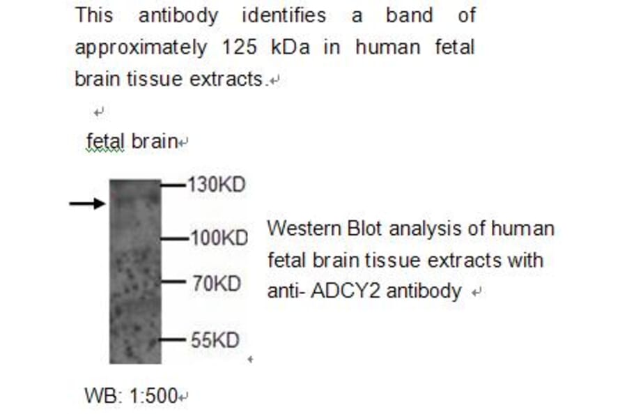 ADCY2 Antibody from Signalway Antibody (39212) - Antibodies.com