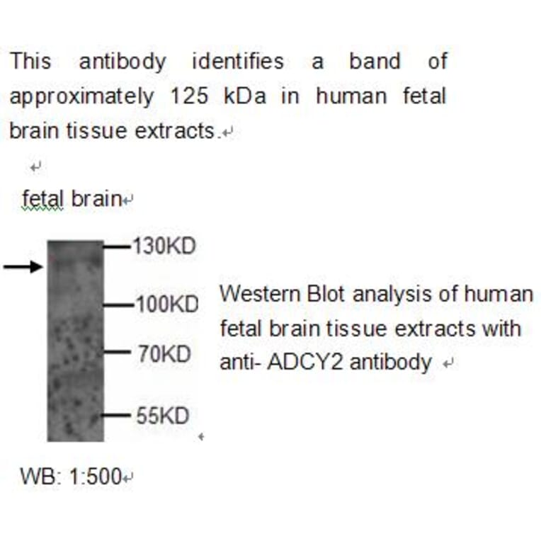 ADCY2 Antibody from Signalway Antibody (39212) - Antibodies.com