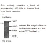 ADCY2 Antibody from Signalway Antibody (39212) - Antibodies.com