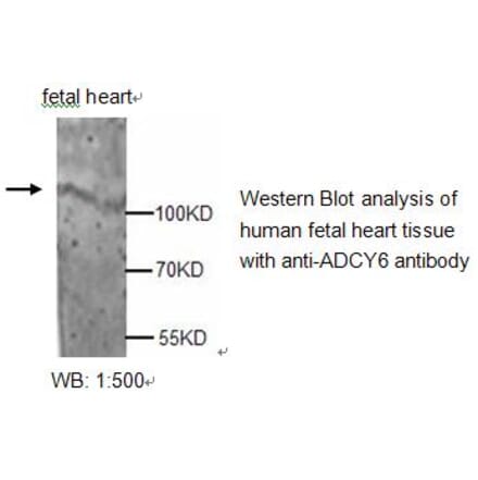 ADCY6 Antibody from Signalway Antibody (39213) - Antibodies.com