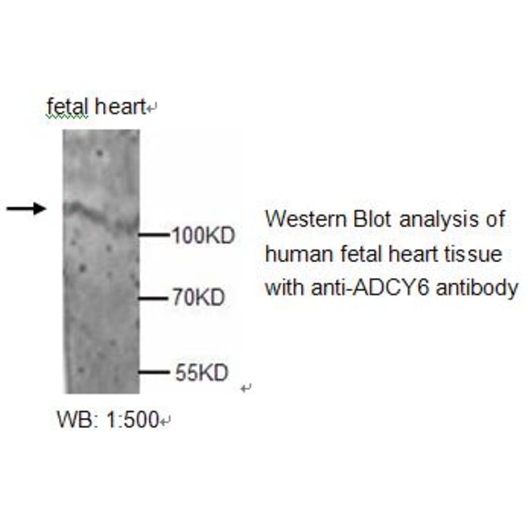 ADCY6 Antibody from Signalway Antibody (39213) - Antibodies.com