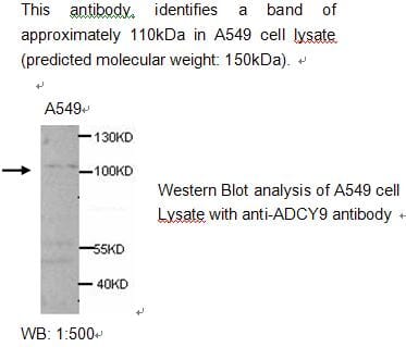 Anti-ADCY9 Antibody