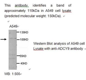 ADCY9 Antibody from Signalway Antibody (39214) - Antibodies.com