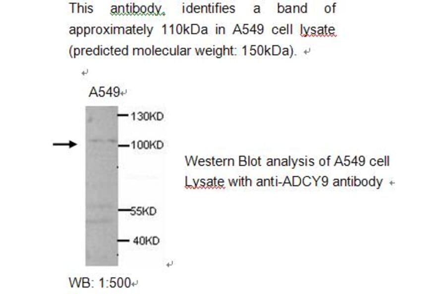 ADCY9 Antibody from Signalway Antibody (39214) - Antibodies.com