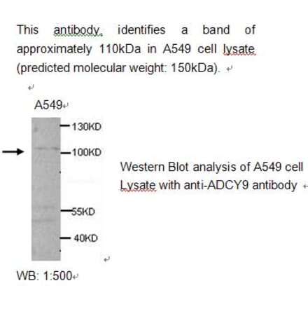 ADCY9 Antibody from Signalway Antibody (39214) - Antibodies.com