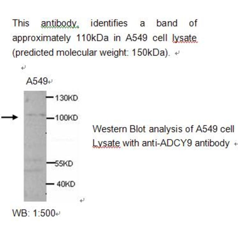 ADCY9 Antibody from Signalway Antibody (39214) - Antibodies.com
