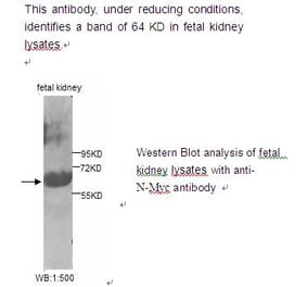 N-Myc Antibody from Signalway Antibody (39222) - Antibodies.com
