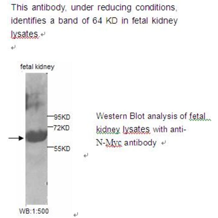 N-Myc Antibody from Signalway Antibody (39222) - Antibodies.com