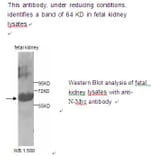 N-Myc Antibody from Signalway Antibody (39222) - Antibodies.com