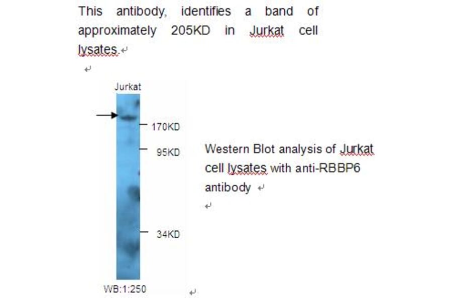 RBBP6 Antibody from Signalway Antibody (39226) - Antibodies.com
