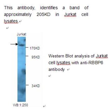 RBBP6 Antibody from Signalway Antibody (39226) - Antibodies.com