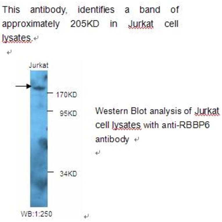 RBBP6 Antibody from Signalway Antibody (39226) - Antibodies.com