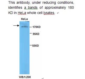 TOP2B Antibody from Signalway Antibody (39231) - Antibodies.com