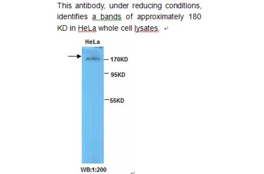 TOP2B Antibody from Signalway Antibody (39231) - Antibodies.com