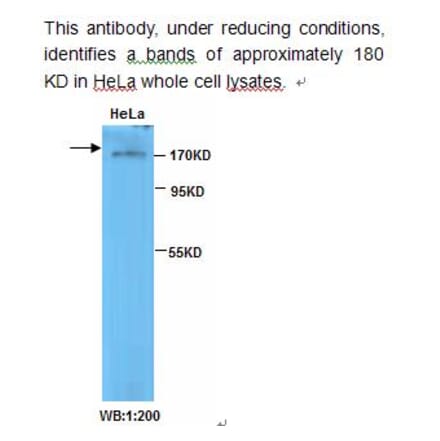 TOP2B Antibody from Signalway Antibody (39231) - Antibodies.com