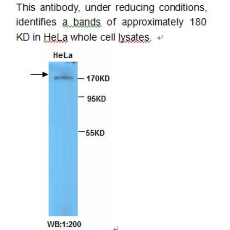 TOP2B Antibody from Signalway Antibody (39231) - Antibodies.com