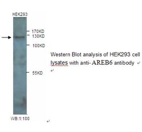 AREB6 Antibody from Signalway Antibody (39245) - Antibodies.com