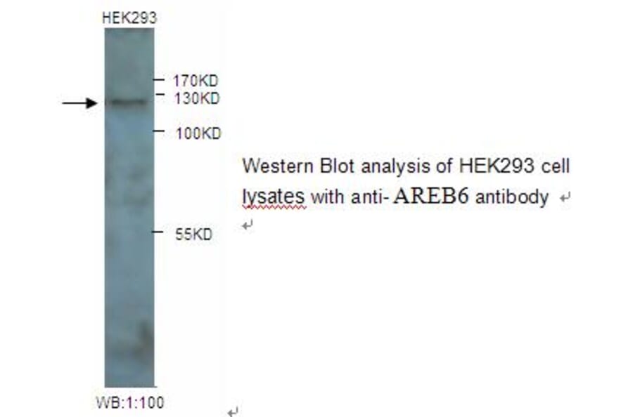AREB6 Antibody from Signalway Antibody (39245) - Antibodies.com
