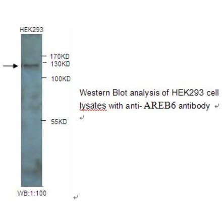 AREB6 Antibody from Signalway Antibody (39245) - Antibodies.com