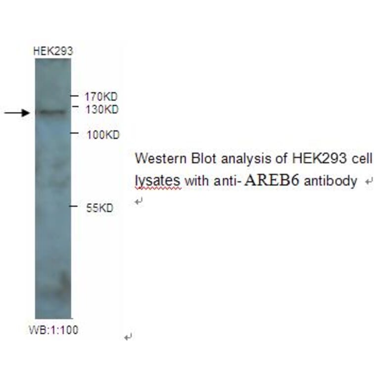 AREB6 Antibody from Signalway Antibody (39245) - Antibodies.com
