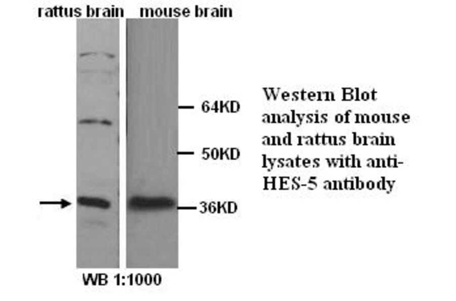 HES-5 Antibody from Signalway Antibody (39252) - Antibodies.com