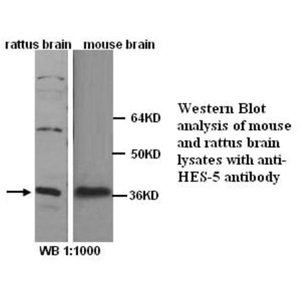 HES-5 Antibody from Signalway Antibody (39252) - Antibodies.com