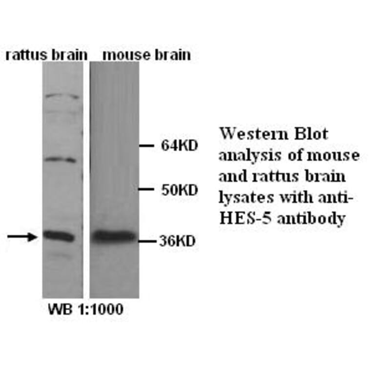 HES-5 Antibody from Signalway Antibody (39252) - Antibodies.com