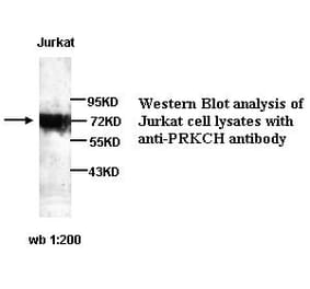 PRKCH Antibody from Signalway Antibody (39256) - Antibodies.com