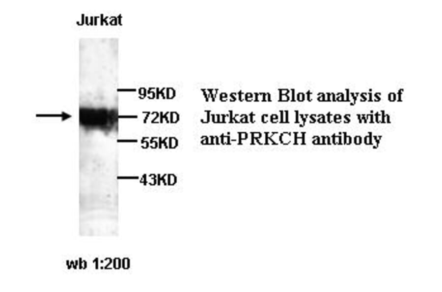 PRKCH Antibody from Signalway Antibody (39256) - Antibodies.com