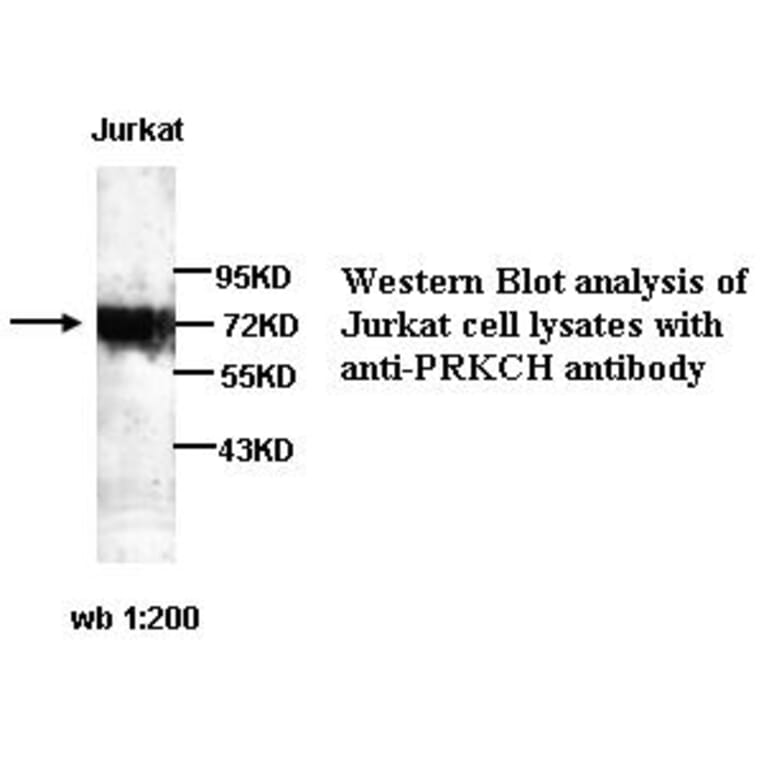 PRKCH Antibody from Signalway Antibody (39256) - Antibodies.com